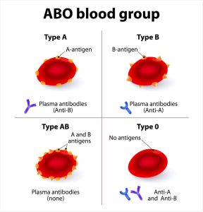abo grouping respiratory grupper chromosome susceptibility darah golongan antigen gruppen antibodies sangue cov sars gruppi sanguigni severe locus associate diagramm