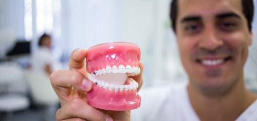 Affordable Dentures